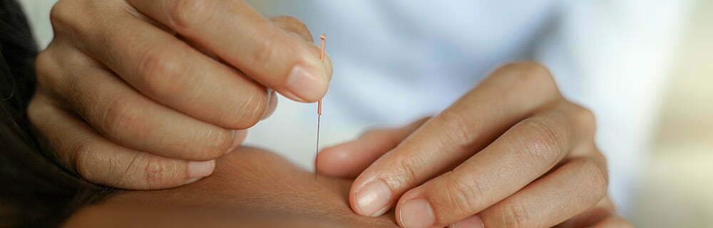 acupuncture calgary